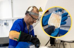 San Giovanni Rotondo, Casa Sollievo: una donazione di sangue cordonale salva una paziente con leucemia